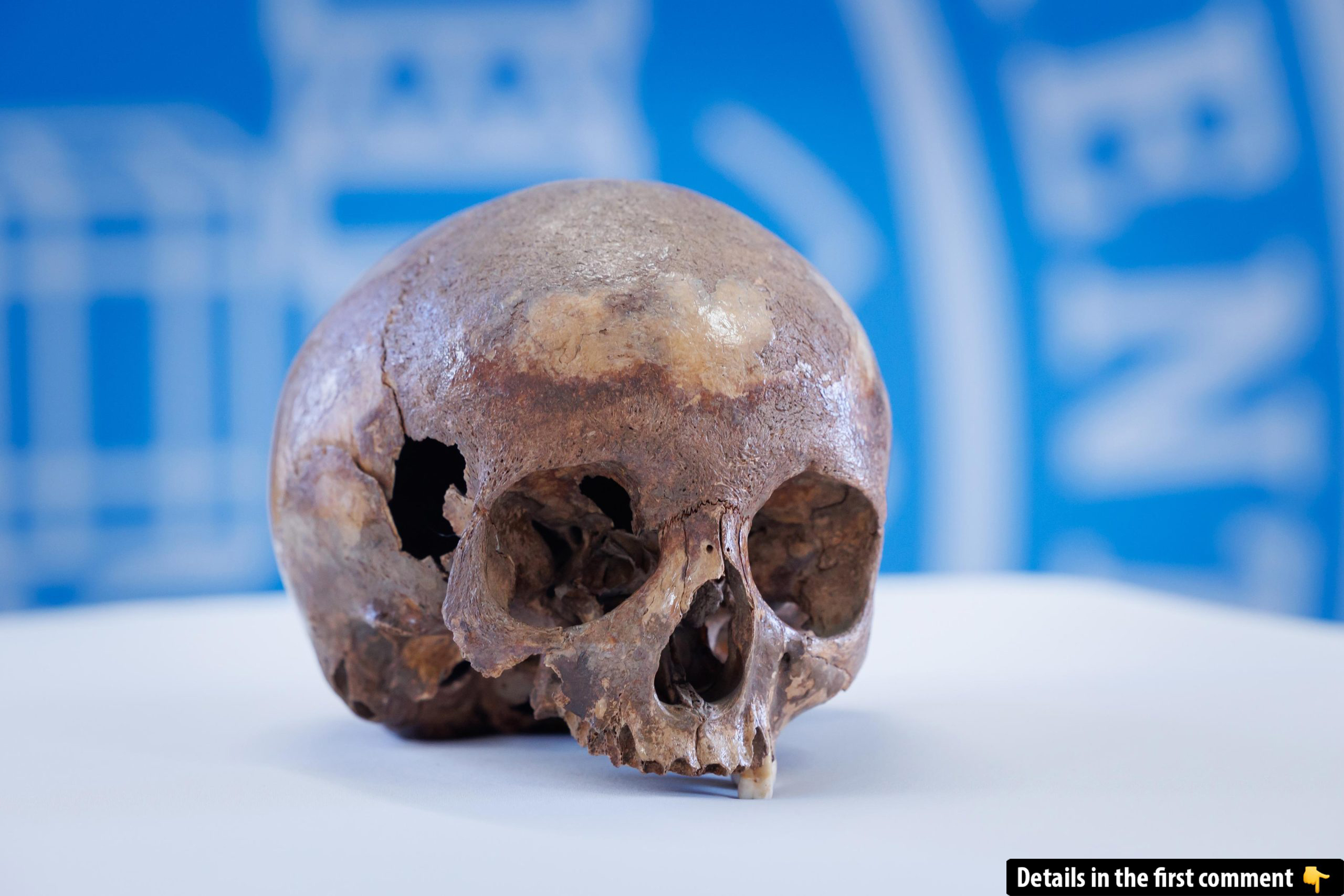 The skull discovered in the Octagon building in Ephesus, Turkey, offers a fascinating glimpse into ancient history. (Image credit: Austrian Academy of Sciences / Austrian Archaeological Institute)